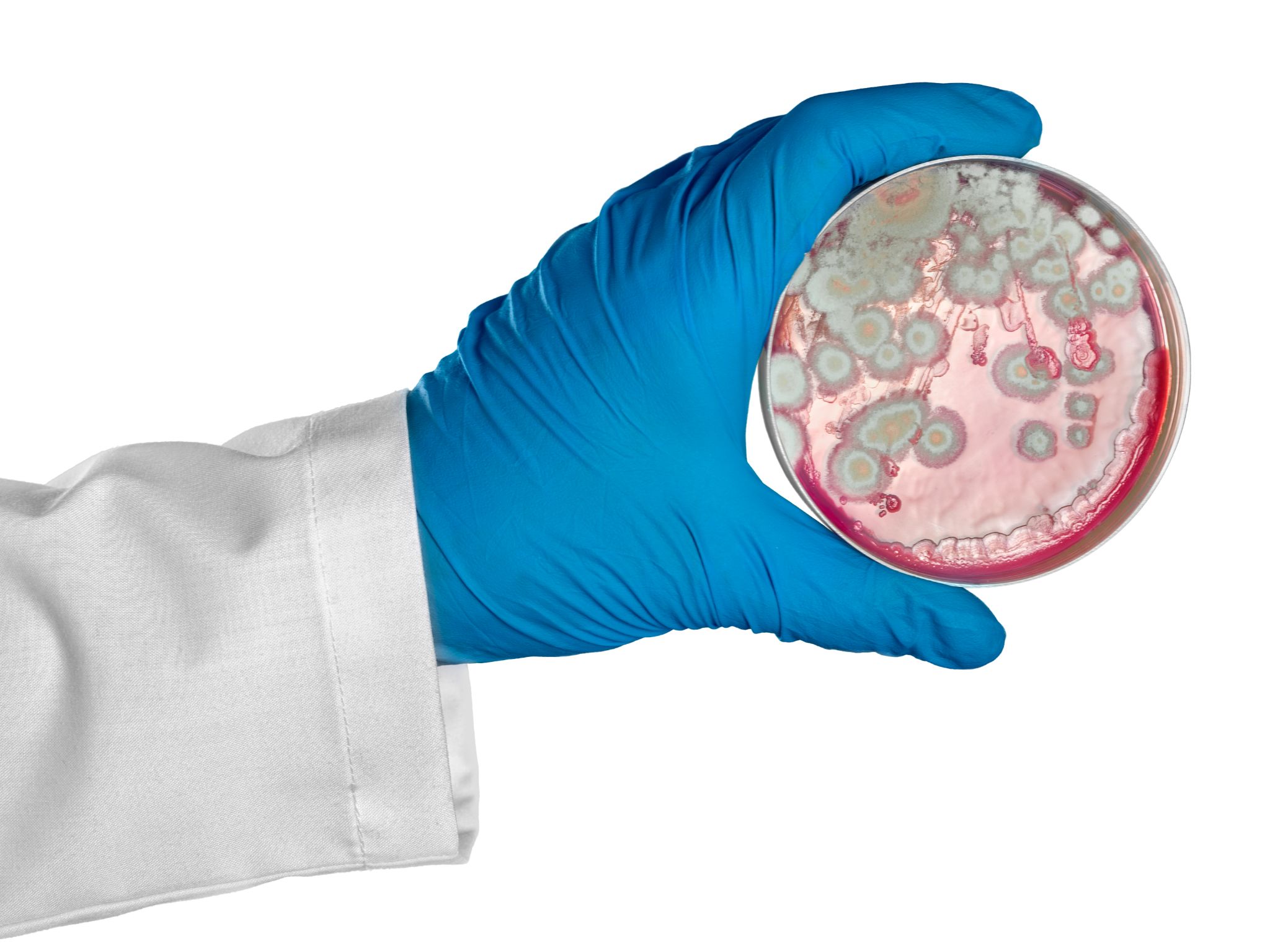 Hand wearing a rubber glove holds up a petri dish containing pink and green mold